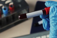 Aggiornamento tecnologico Laboratorio Analisi: possibili rallentamenti