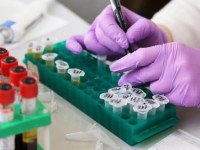 Sperimentazione Tocilizumab - Analisi preliminari sui dati