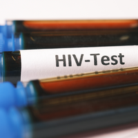 Parma testing day: il 29 novembre test HIV gratuiti in piazza