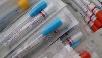 Esiti in un quarto d'ora, parte in Emilia-Romagna la distribuzione del primo milione di tamponi antigenici rapidi